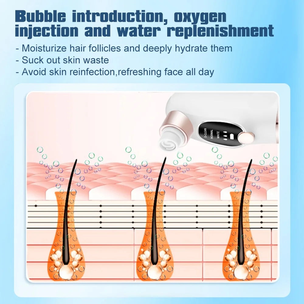 PoreClear™ - Water Cycle Blackhead Vacuum