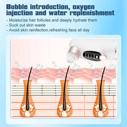 PoreClear™ - Water Cycle Blackhead Vacuum