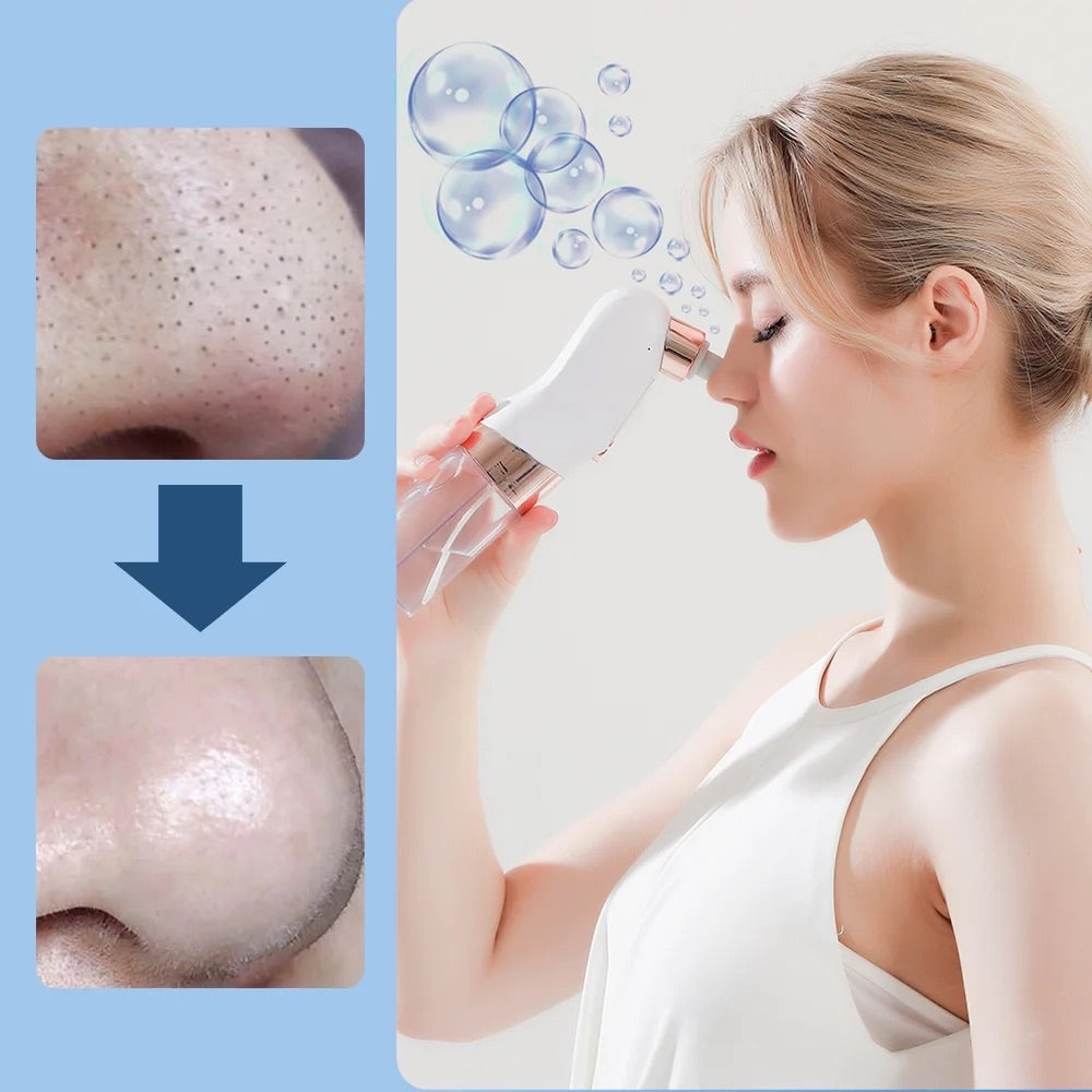 PoreClear™ - Water Cycle Blackhead Vacuum